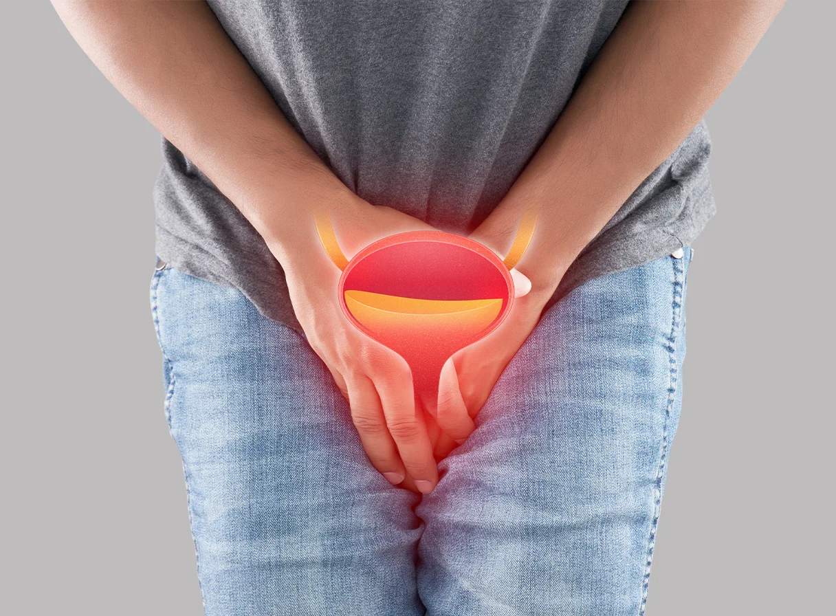 Urinary Tract Infections (UTIs): Causes, Symptoms, and Treatment